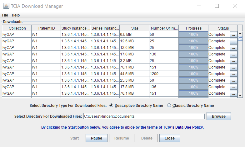 TCIA Download Manager, downloads complete