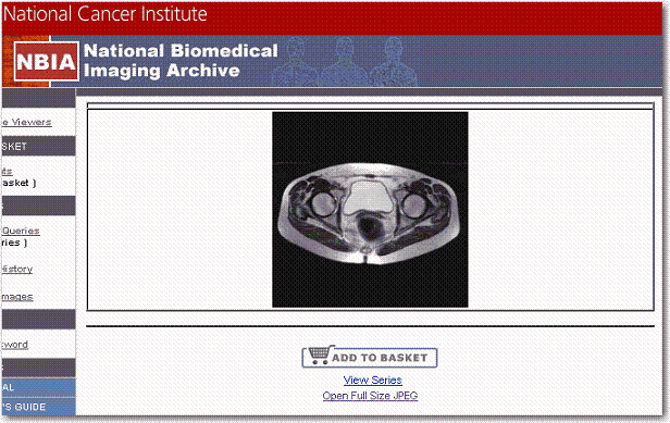 An example of displaying the first image in image series