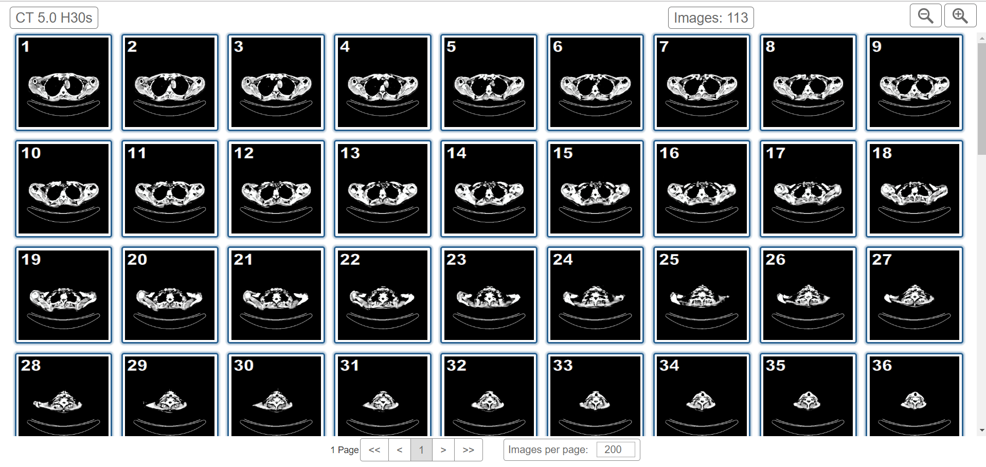Thumbnails of all images in a selected image series
