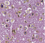 Image tile from whole slide tissue image